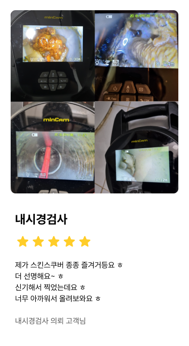 내시경검사_1